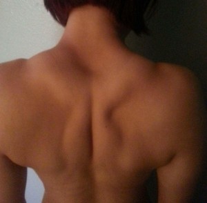 Am I Anorexic? Asian Girl Body Issues